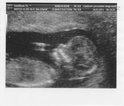 16.3.2011