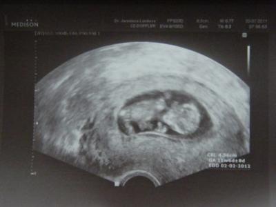 20_června_2011 (2).JPG