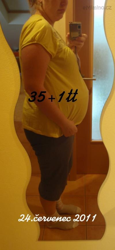 35+1tt