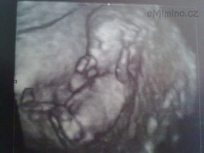 26042011520.jpg