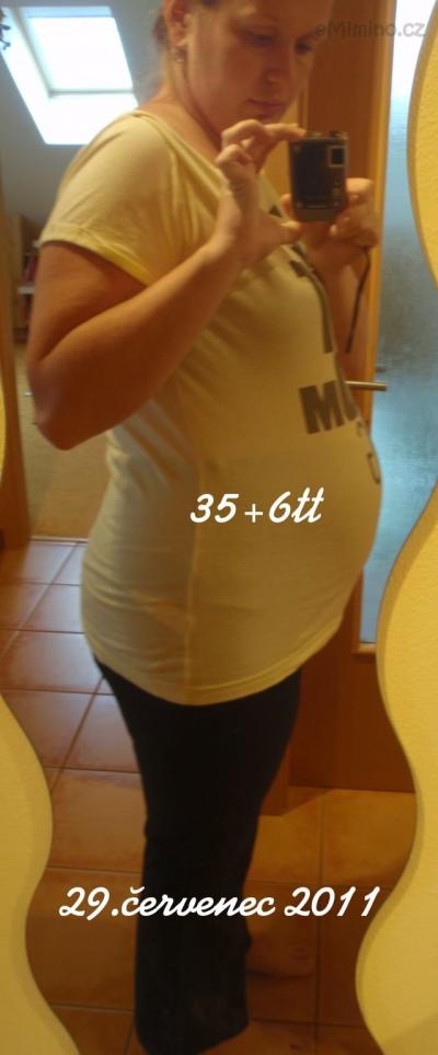 35+6tt