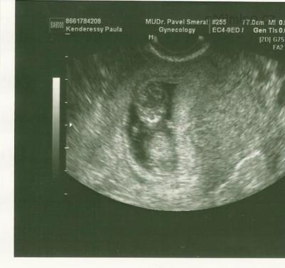 scan0005.png