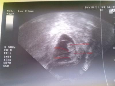 10+2 tt 4.10.2011.jpg