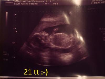 21 tt  20.09.2011.JPG