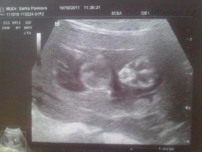 18102011644.jpg
