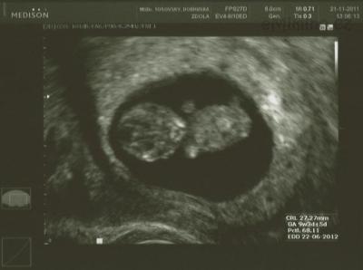 Ultrazvuk-11-11-21-s.jpg