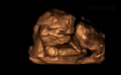 Maxík 3