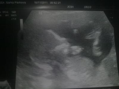 08122011889.jpg