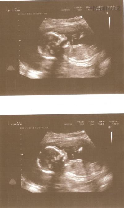 sofinka