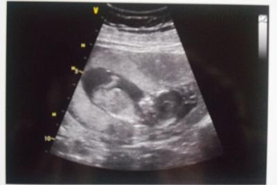 CIMG1206.JPG