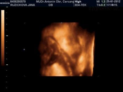 Snímek 5 (25.1.2012 20-38).png