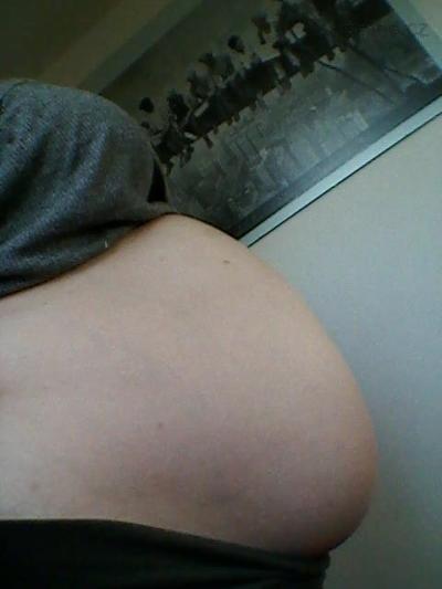 26+5