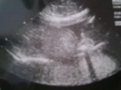 01022012450.jpg