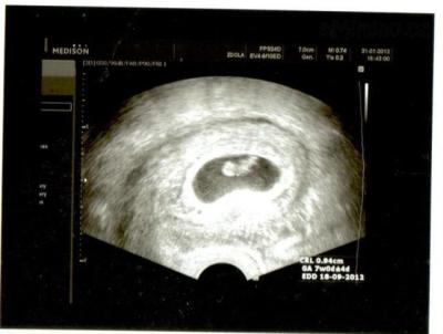 7tt - 31.1.2011