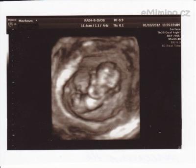 12+0 screening-2 3D.jpg
