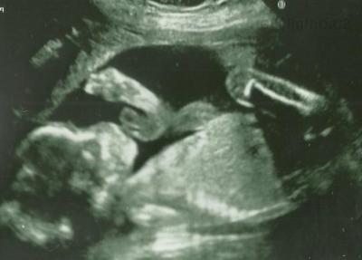 15.11.2011.jpg