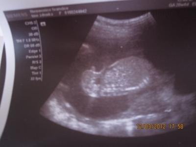 21.2.12