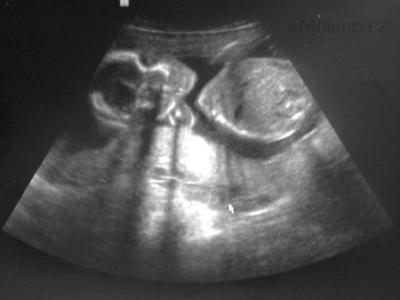 20.týden, 15cm, 320g.JPG