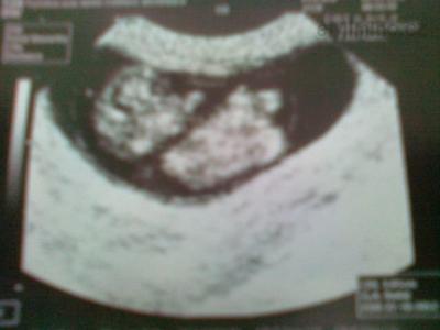 26032012436.jpg