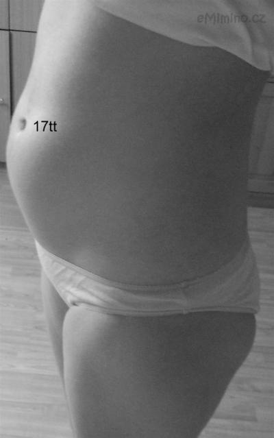 17tt