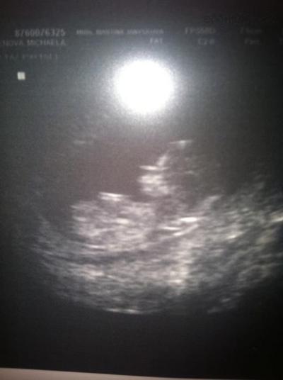 13. tt