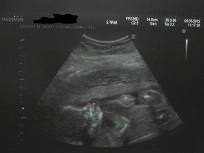 22.tt