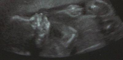 22.tt