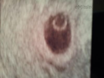 20120625_193324.jpg