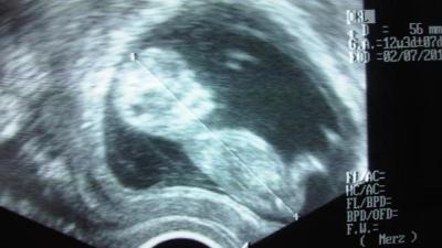 IMG00287-20101221-.jpg