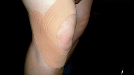 Kineziotaping