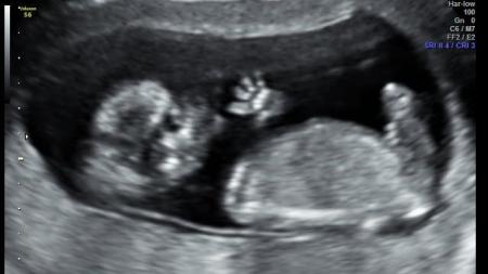 15tt