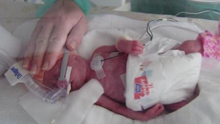 Adelka 770g 34cm