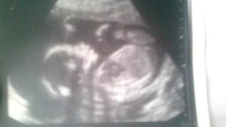 nase Vaneska:-)