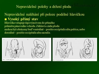 slide_46.jpg