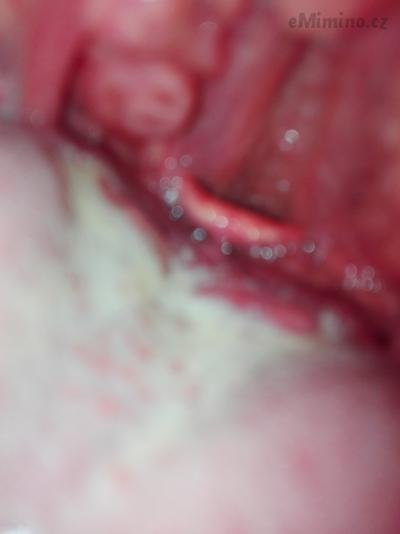 IMG_20170928_085242_BURST001_COVER.jpg