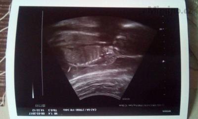 received_1515624788450725.jpeg