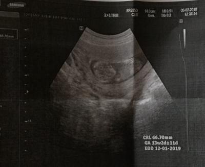 IMG_20180709_123233.jpg