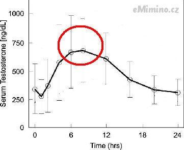 hypogonadism_testosteronelevel001004.jpg