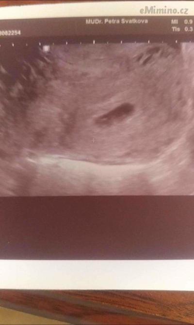 received_1710112095694487.jpeg