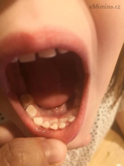 IMG_20181101_204412.jpg