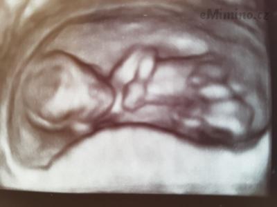 20180420_140628.jpg