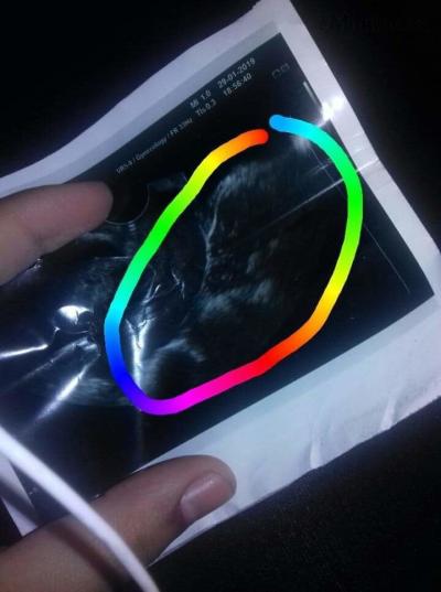 received_371198660365582.jpeg