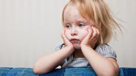 WHO varuje: Počet nakažených spalničkami v Evropě se zdvojnásobil
