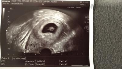 IMG_20201209_111422.jpg