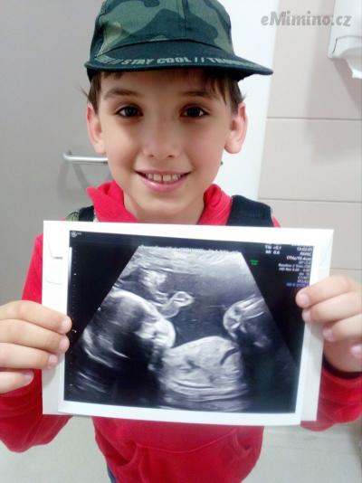 Moje lásky