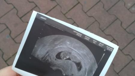 Třetí baby
