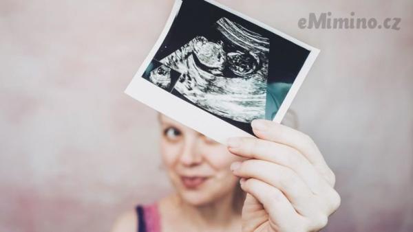 Na ultrazvuku uvidíte své miminko v plné kráse. Zdroj: Canva.