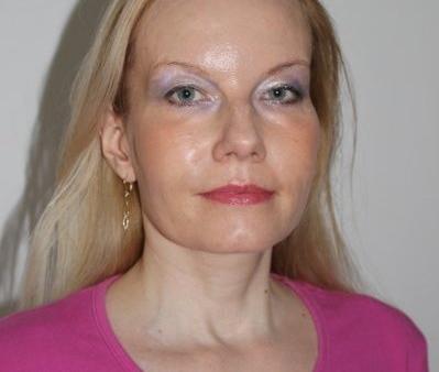 MUDr. Petra Fojtková z ordinace Dermamax.