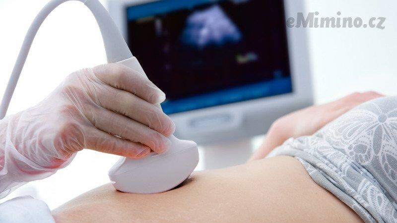 Žena na ultrazvuku u lékařky, která může potvrdit její těhotenství