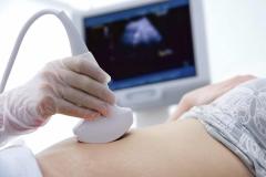 III. Otěhotnění s PCOS: Pozitivní test na Downův syndrom